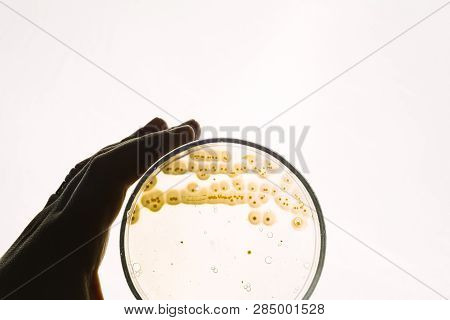 Hand Holds Petri Dish With E.coli Escherichia Bacteria. Lab Testing For Intestinal Infection.bacteri