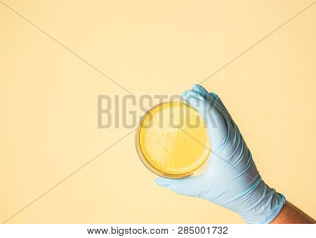 Hand Holds Petri Dish With E.coli Escherichia Bacteria. Lab Testing For Intestinal Infection.bacteri