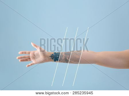Young Woman Before And After Laser Tattoo Removal Procedure On Color Background, Closeup