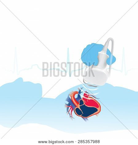 Echocardiogram White Background. Info Graphic.heart Examination With High Frequency Sound Waves Very
