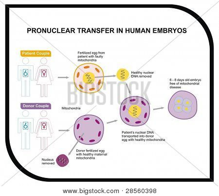 โอน pronuclear ในการโคลนมนุษย์