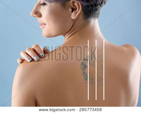 Young Woman Before And After Laser Tattoo Removal Procedure, Closeup