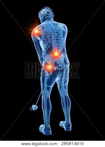 3d rendered medically accurate illustration of the skeleton of a golf player with painful joints
