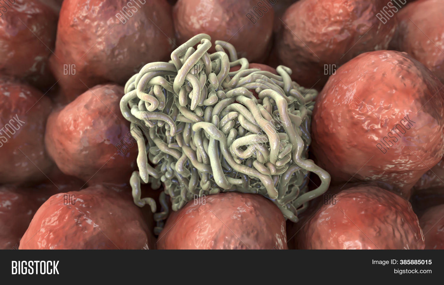 Parasitic Worms Image & Photo (Free Trial) | Bigstock