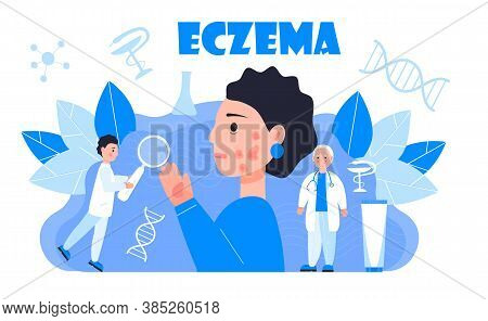 Eczema, Psoriasis Concept Vector. Sad Cute Girl On The Blue Background. Tine Dermatologists Treat Ec