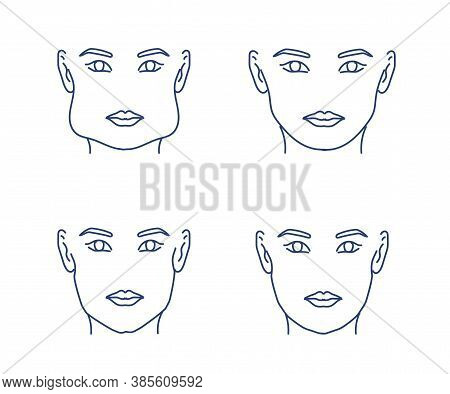 Woman's Face On A White Background. Cheekbone Correction. Vector Illustration.
