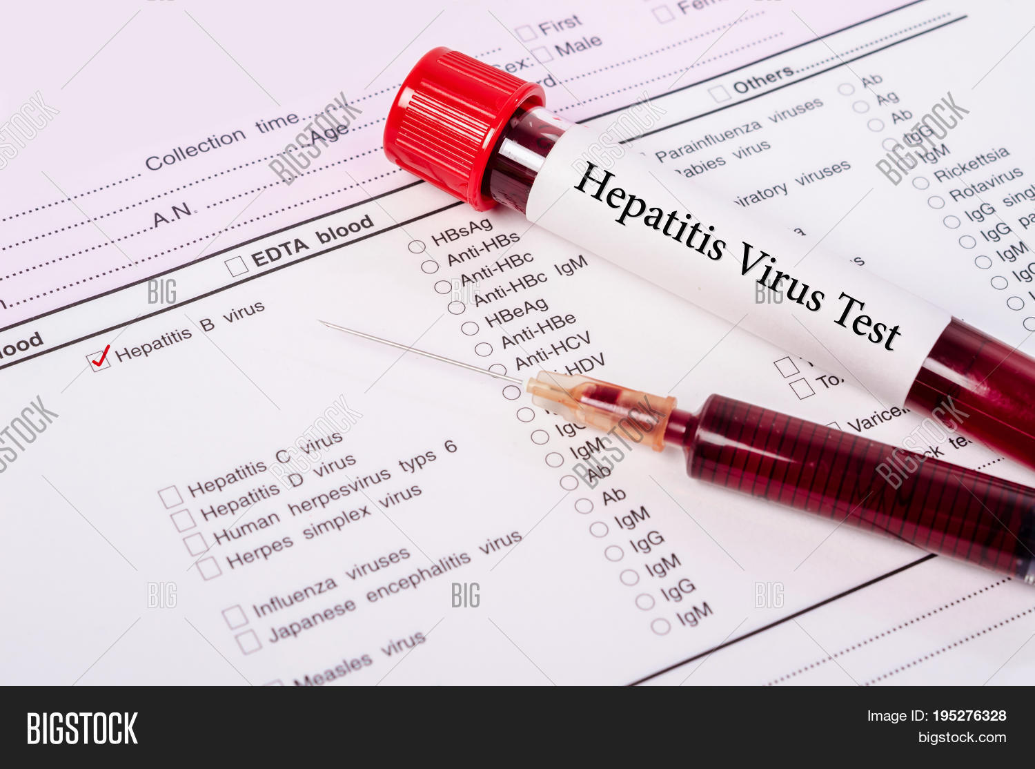 Blood Sample Hepatitis Image & Photo (Free Trial) Bigstock