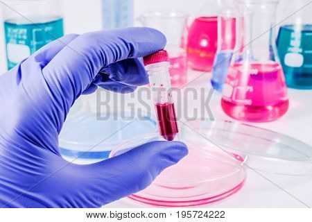 Analysis of samples laboratory. Medical Research and science