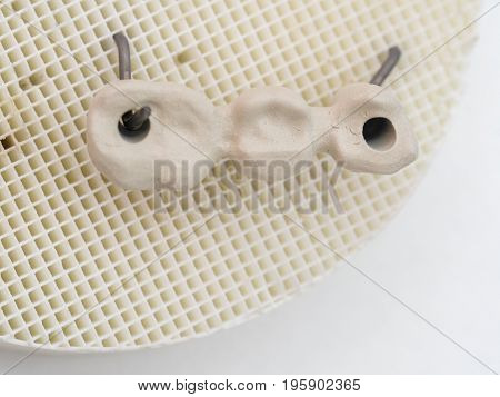 Mplants Teeth Made In The Technic Opaque Porcelain Dental. Oxidized Metal Opaque.