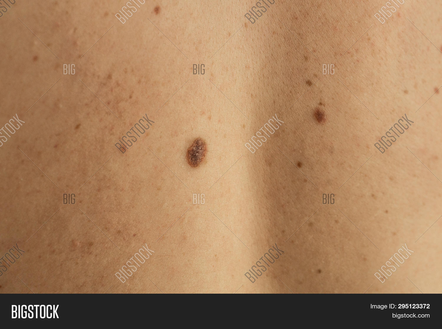 Close Detail Bare Skin Image & Photo (Free Trial) | Bigstock
