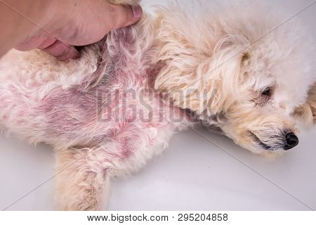 Body With Red Irritated Skin Due To Kerato-seborrhoeic Disorders