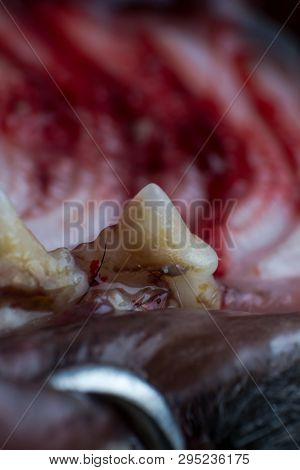 Cat Tooth With Infection And Gingival Retraction Macro View