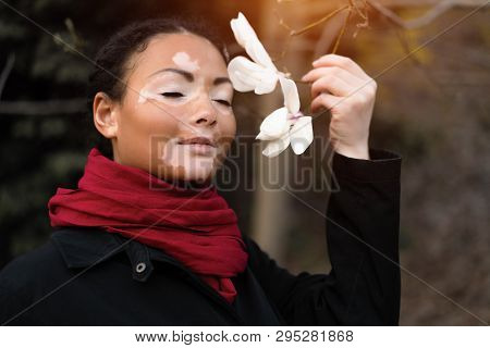 Beautiful African Girl With Vitiligo Standing On The Street Sniffs Spring Flowers. Magnolia Spring B