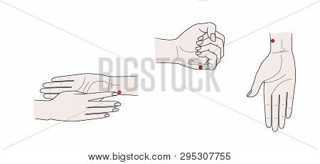Active Acupuncture Points On The Hands. Isolated On White Background