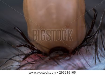 The Tick Sucking Blood From A Cat's Skin. Tick Attached To The Cat Skin