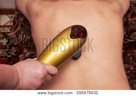 Male Patient Receive Electrostatic Therapy Procedure On His Back. Electrostimulation Massage Close-u