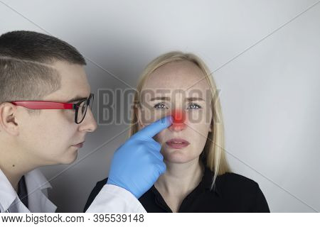 Nasal Bridge Pain, Headache. A Woman Holds His Nose With His Hand And Winces In Pain. Signs Of Acute
