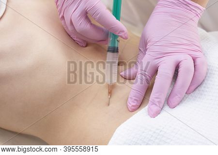 Lipolytic Injections Are Placed In The Stomach. Female Hands In Pink Gloves Inject A Young Woman Int