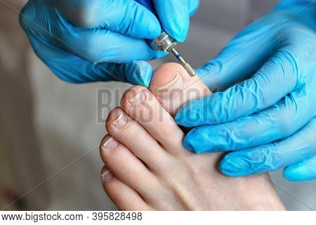 Hardware Pedicure, Preparation Of The Nail Plate For Applying Gel Polish. Master Chiropody Shapes Th
