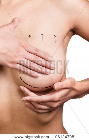 Boobs correction with help of plastic surgery