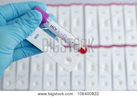Hepatitis C virus (HCV) testing positive