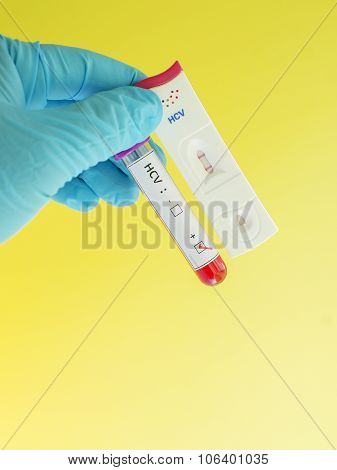 Hepatitis C virus (HCV) testing positive