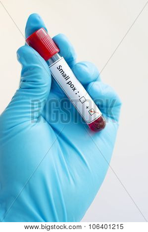 Smallpox blood sample