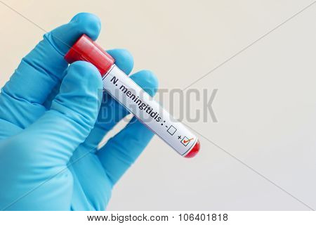 Neisseria meningitides blood sample