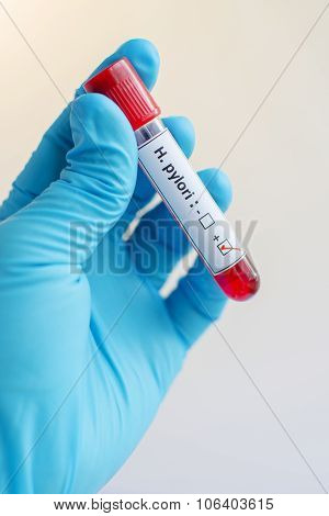Helicobacter pylori blood sample