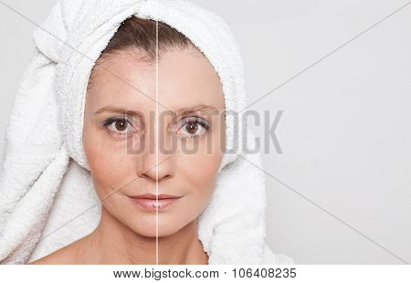 Beauty concept - skin care, anti-aging procedures, rejuvenation, lifting, tightening of facial skin
