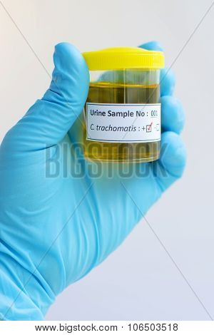 Chlamydia trachomatis