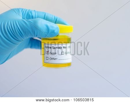 Urine exam