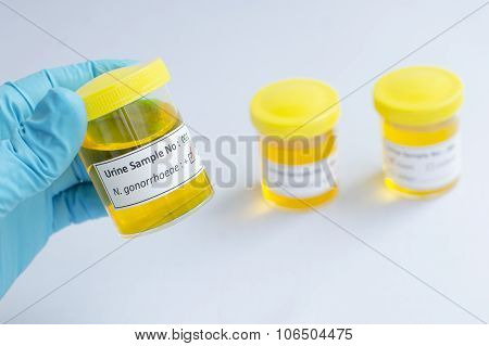 Neisseria gonorrhoeae positive