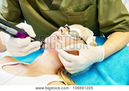 Skincare laser cosmetology procedure of spot papula removal or pigment color change on young woman face