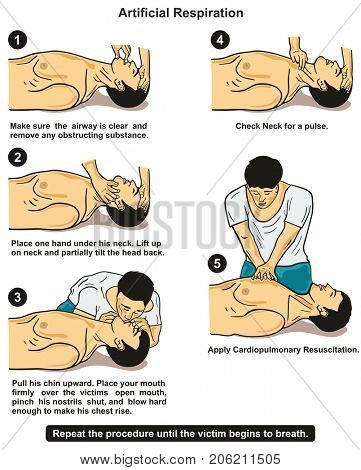 Artificial Respiration infographic diagram step by step poster with instructions showing a first aider providing it to a victim for emergency first aid medical education and health care