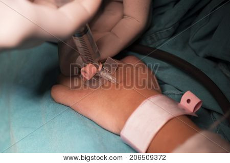 Anesthesiologist flushing saline into the needle after intravenous cannulation cannulation flush