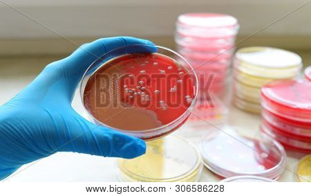 Medical Clinic Pathological Bacteria Cultivation Sample Test