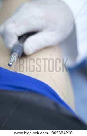 Epi Needling Physical Therapy