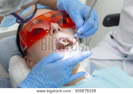 Girl On Examination At The Dentist. Treatment Of Carious Tooth. The Doctor Uses A Mirror On The Hand