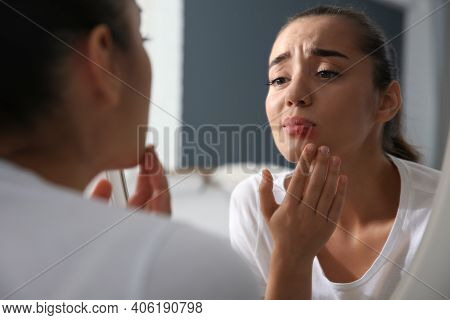 Young Woman With Herpes On Lip Looking In Mirror At Home