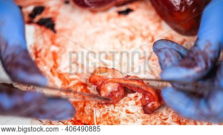 Scientist Showing The Semilunar Valves Of A Fresh Dissected Pig Heart With Scalpel And Tweezers.