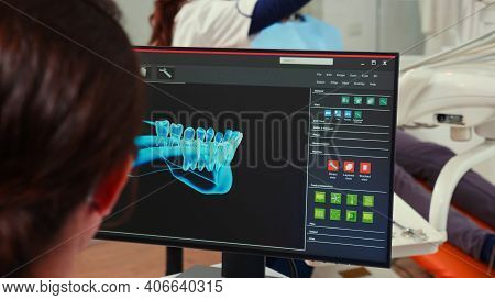 Stomatologist Nurse Looking At Digital Dental Fingerprint On Computer Sitting In Stomatological Clin