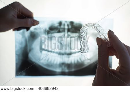 Female Hands With Transparent Mouth Guards For Correcting Bite And X-ray Of The Jaw. The Orthodontis