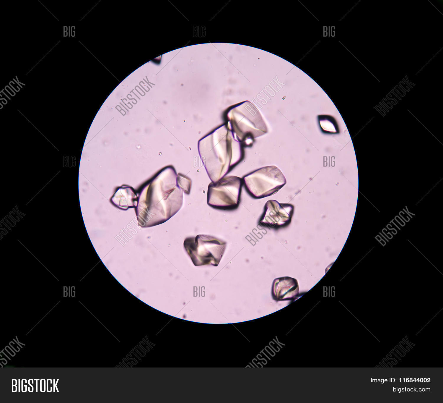 Uric Acid Urine Image & Photo (Free Trial) Bigstock