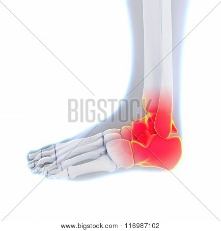 Painful Ankle Illustration