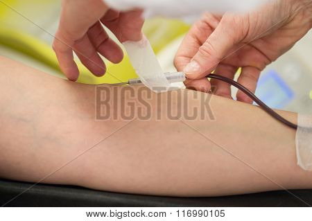 Donor In An Armchair Donates Blood, Inserting The Needle