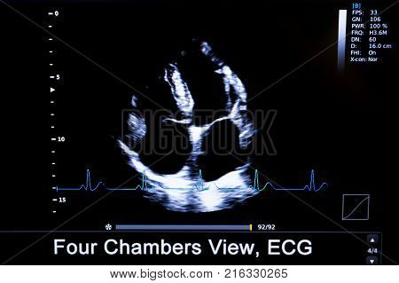Colourful Image Of Homan Heart Ultrasound Monitor