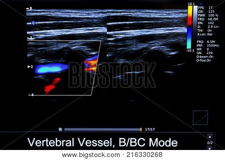 Colourful Image Of Homan Heart Ultrasound Monitor
