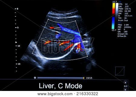 Colourful Image Of Homan Heart Ultrasound Monitor