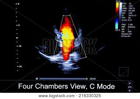 Colourful Image Of Homan Heart Ultrasound Monitor